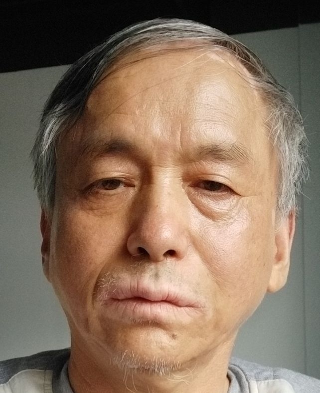 9杰米的第二张照片--台湾残疾人相亲网