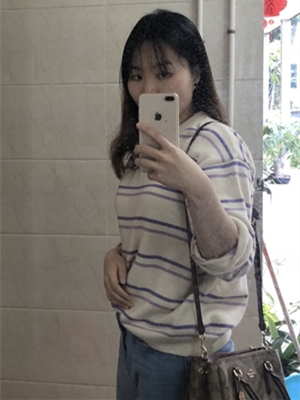 xyz的第一张照片--台湾残疾人相亲网